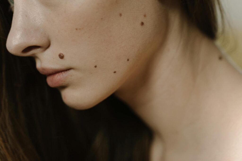 H Warts Formula Review 2026: What You Need to Know