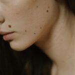 wart removal formula